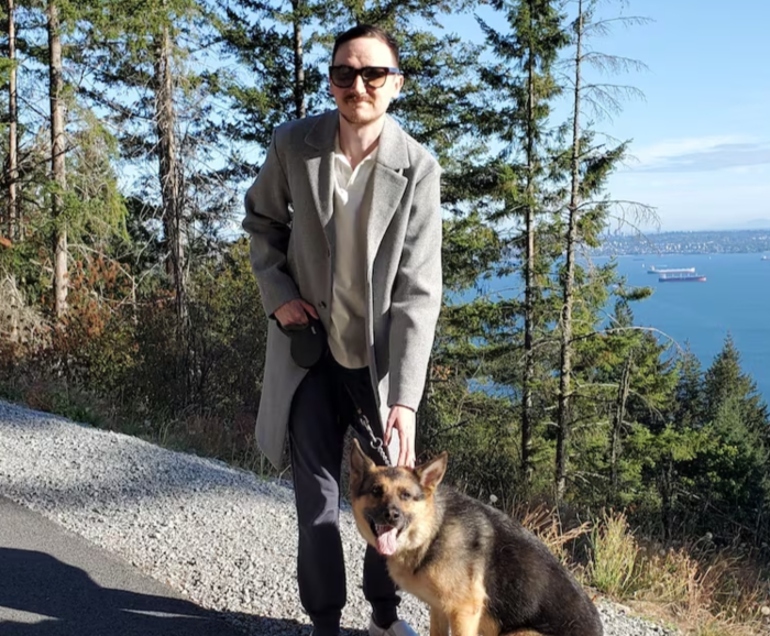 '골치아각막보철술'(OOKP)을 받은 브렌트 채프먼. 사진=브렌트 채프먼