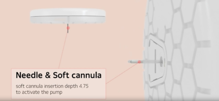 온전히의 무효소 촉매 기반 연속혈당측정기 원리. 일종의 침 역할을 하는 필라멘트 표면에 포도당 포집 성질이 있는 보론산기를 도포해 혈당을 잰다.(출처=온전히)