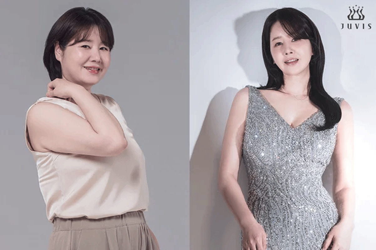 출처 : 쥬비스 다이어트