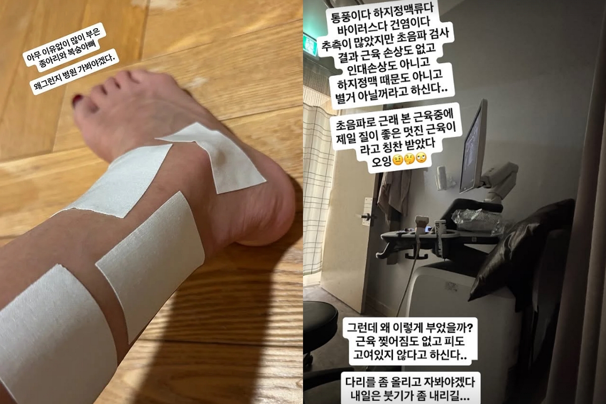 출처: 전미라 SNS