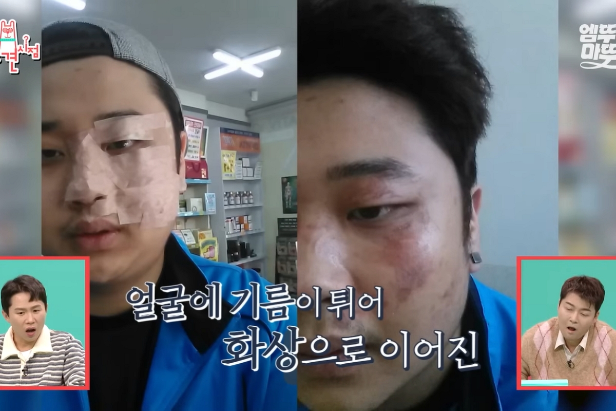 출처: MBC ‘전지적 참견 시점’ 캡처