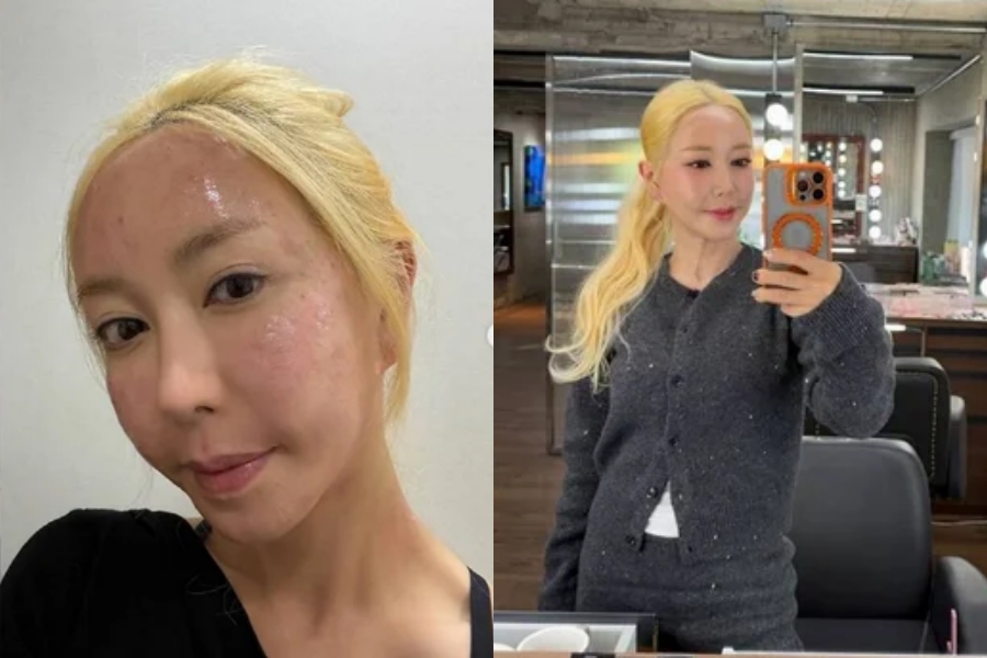 사진: 슈 SNS