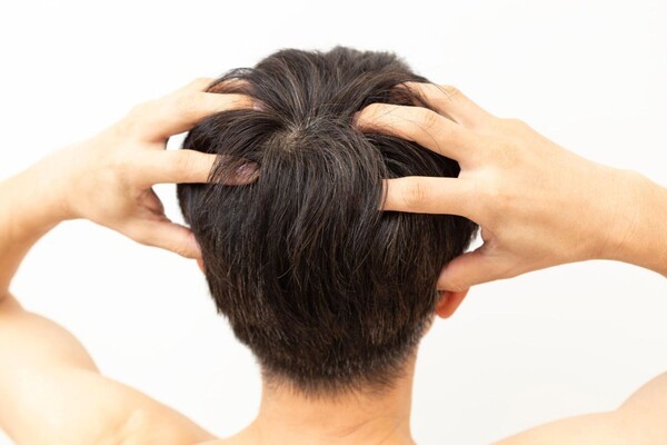 scalp-d