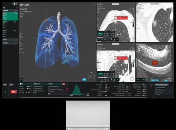 CorelineSoft\'s solution AVIEW / Provided by Coreline Soft