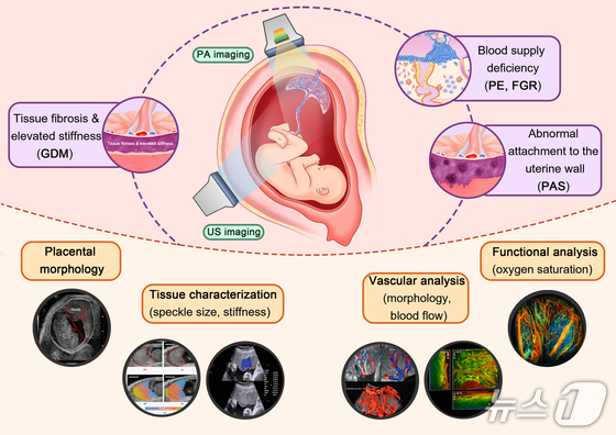 Research image from the joint research team led by Professor Kim Cheol-hong of POSTECH (Provided by POSTECH) 2026.4.7 / News1