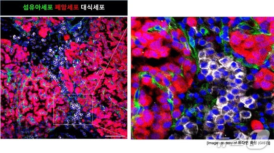 The process by which mutant stem cells alter their surrounding environment in early-stage lung cancer (Provided by GIST) / News1