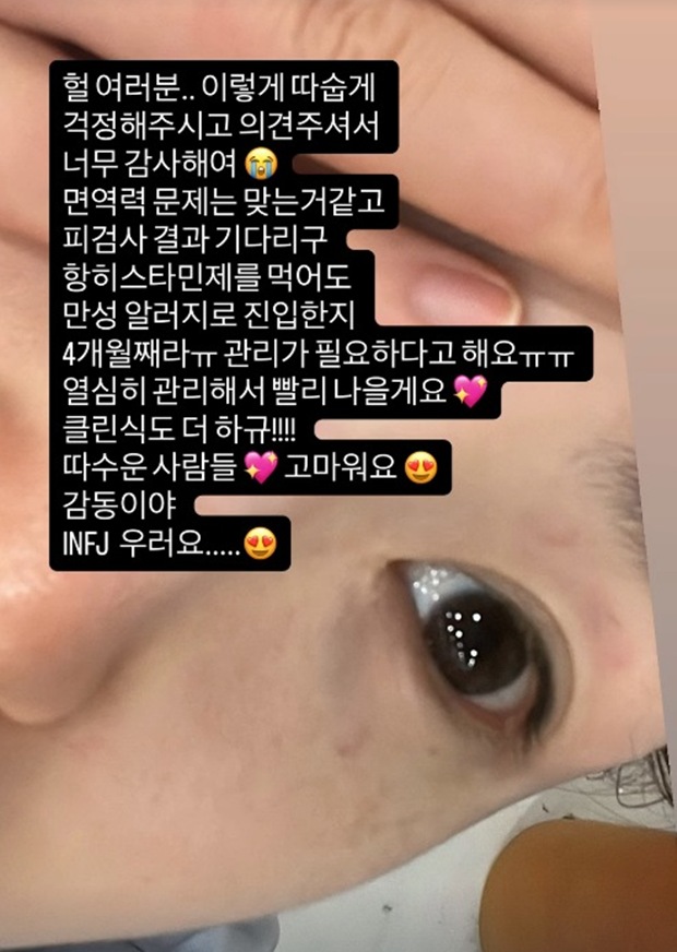 티브이데일리 포토