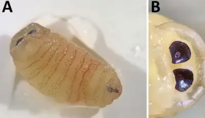 사람의 코에서 발견된 양코파리 유충. 사진= Ilias P. Kioulos, Emmanouil Kokkas, Evangelia-Theophano Piperak