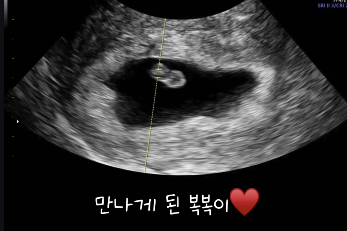출처 : 아야네 SNS