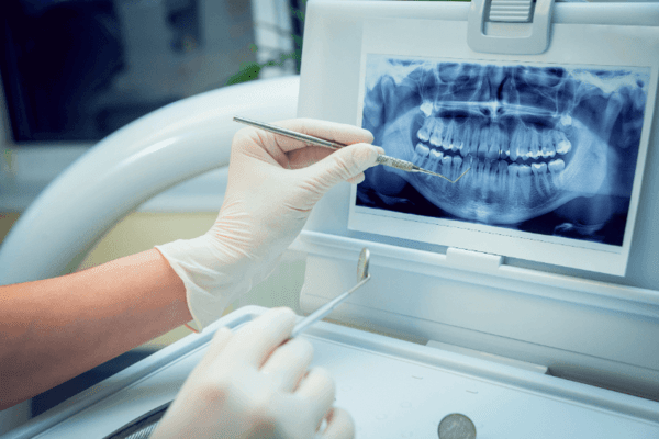 implant