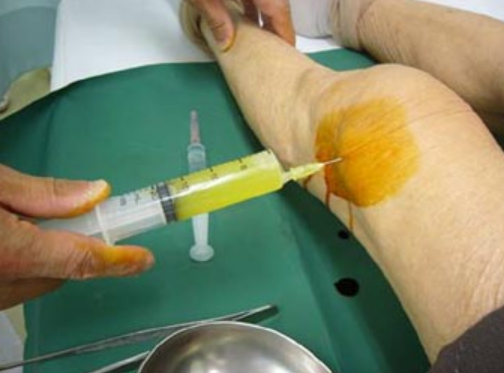 orthopaedics
