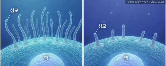 Difference in cilia length when only one of the autism-related gene pairs is mutated (left) versus when both are mutated (right). When both genes in the pair were mutated, there was a marked reduction in cilia formation on the cell surface / Provided by Bundang Seoul National University Hospital