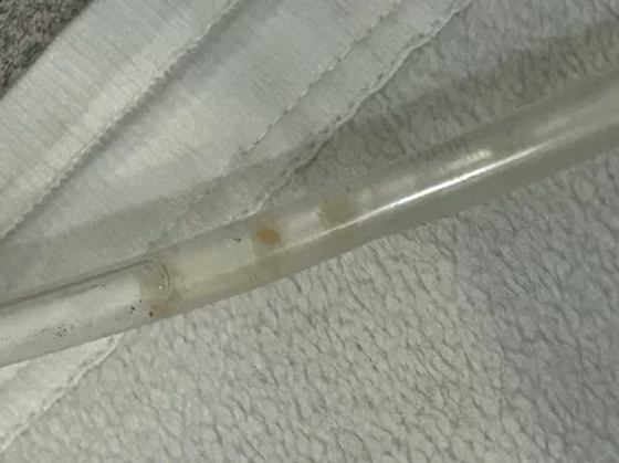 Mycelium found in the urinary catheter (Provided by Signature Animal Medical Center) / News1