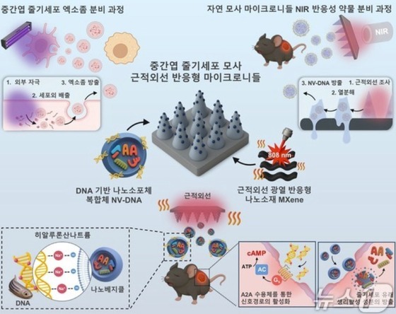 Schematic diagram of stem cell-mimicking near-infrared (NIR)-responsive microneedles for the treatment of chronic diabetic wounds / Provided by the National Research Foundation of Korea