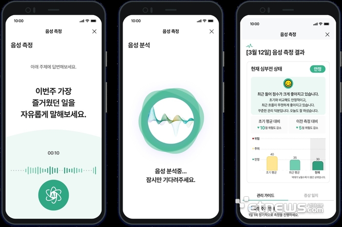 에이닷큐어의 음성 분석 기반의 심부전 상태변화 조기감지 AI 모델 'Heart to Voice'