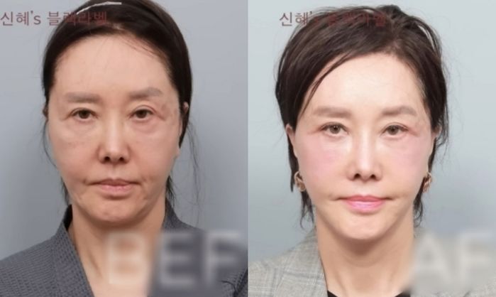 애니멀플래닛