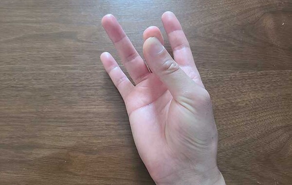 grapee