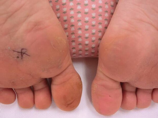 koto-orthopaedics