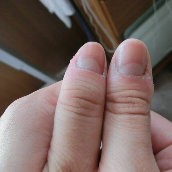ameba