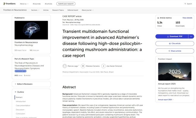 引用:Frontiers in Neuroscience