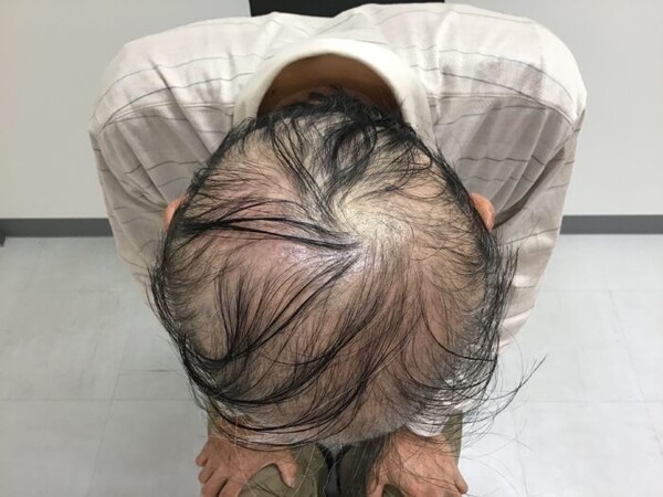 e-aga