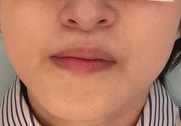 ameblo