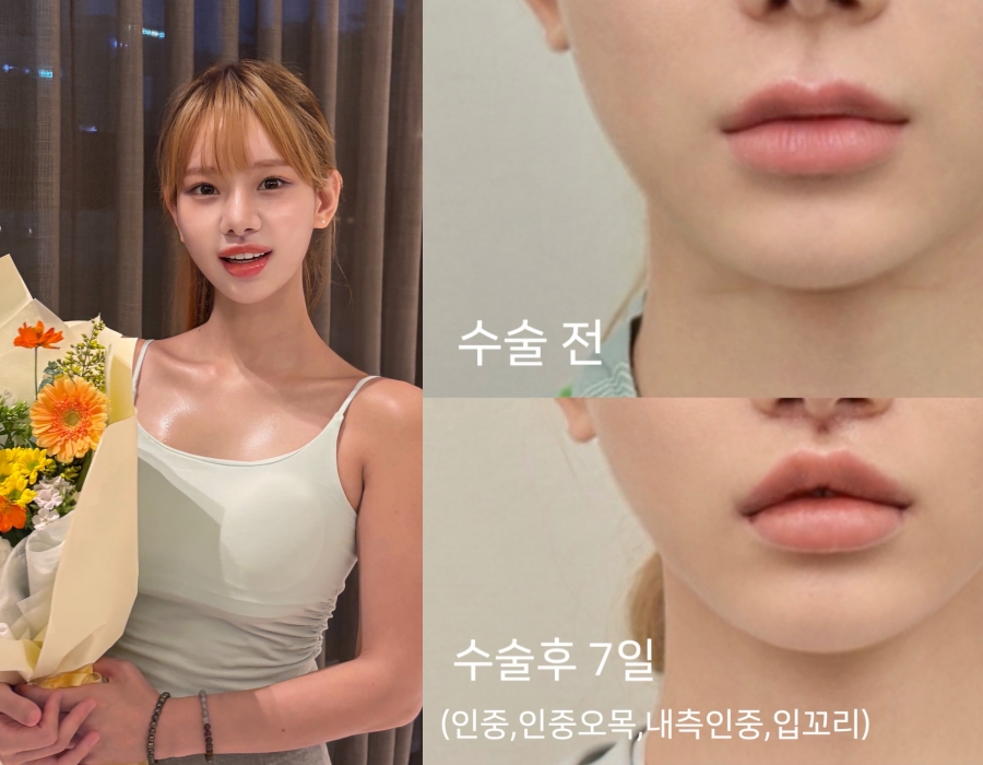 사진 : 맹승지 인스타그램