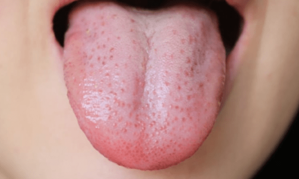 온라인 커뮤니티