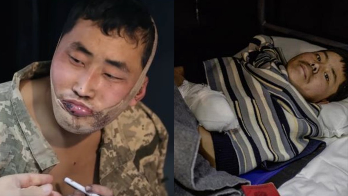 우크라이나 보안국(SBU)이 공개한 생포된 북한군 2명 / 우크라이나 보안국