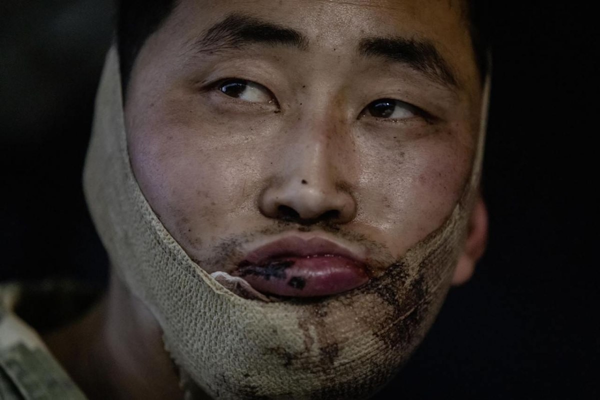 우크라이나군에 생포된 북한군. / 젤렌스키 대통령 SNS 캡처-뉴스1