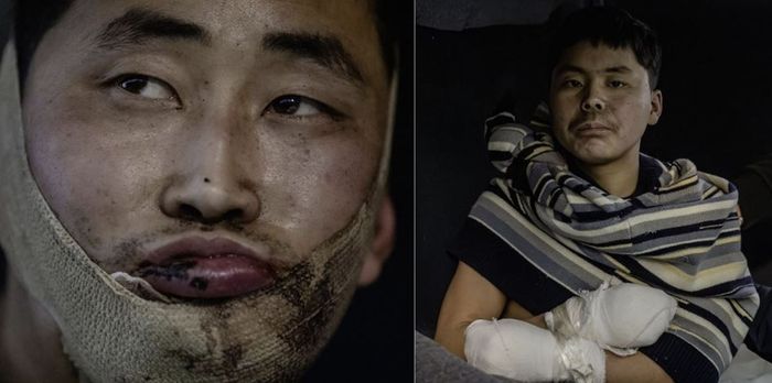 볼로디미르 젤렌스키 우크라이나 대통령이 지난해 1월 11일 공개한 생포된 북한 군인들. ⓒ 젤렌스키 대통령 X 캡처
