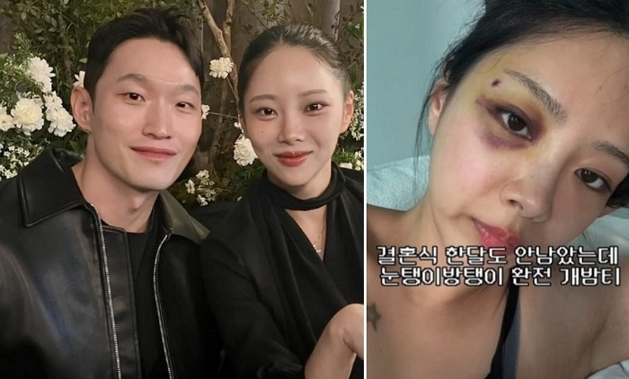 [사진=김슬기 SNS]